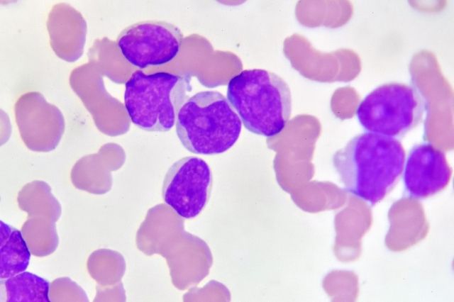 Leucemia Felina, una enfermedad crónica que afecta el sistema inmune